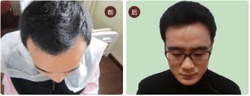 与金毛的亲密关系：探索和谐共处的秘诀