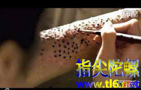 芝麻女孩恐怖图像背后的神秘皮肤病真相，点击探索！